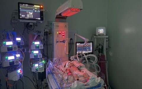 Bebê supera quadro gravíssimo e deixa UTI neonatal sem sequelas em Feira