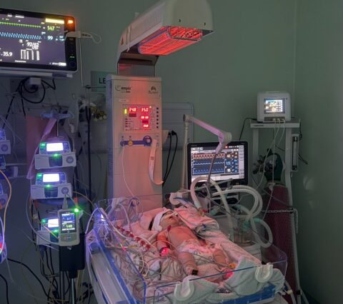 Bebê supera quadro gravíssimo e deixa UTI neonatal sem sequelas em Feira